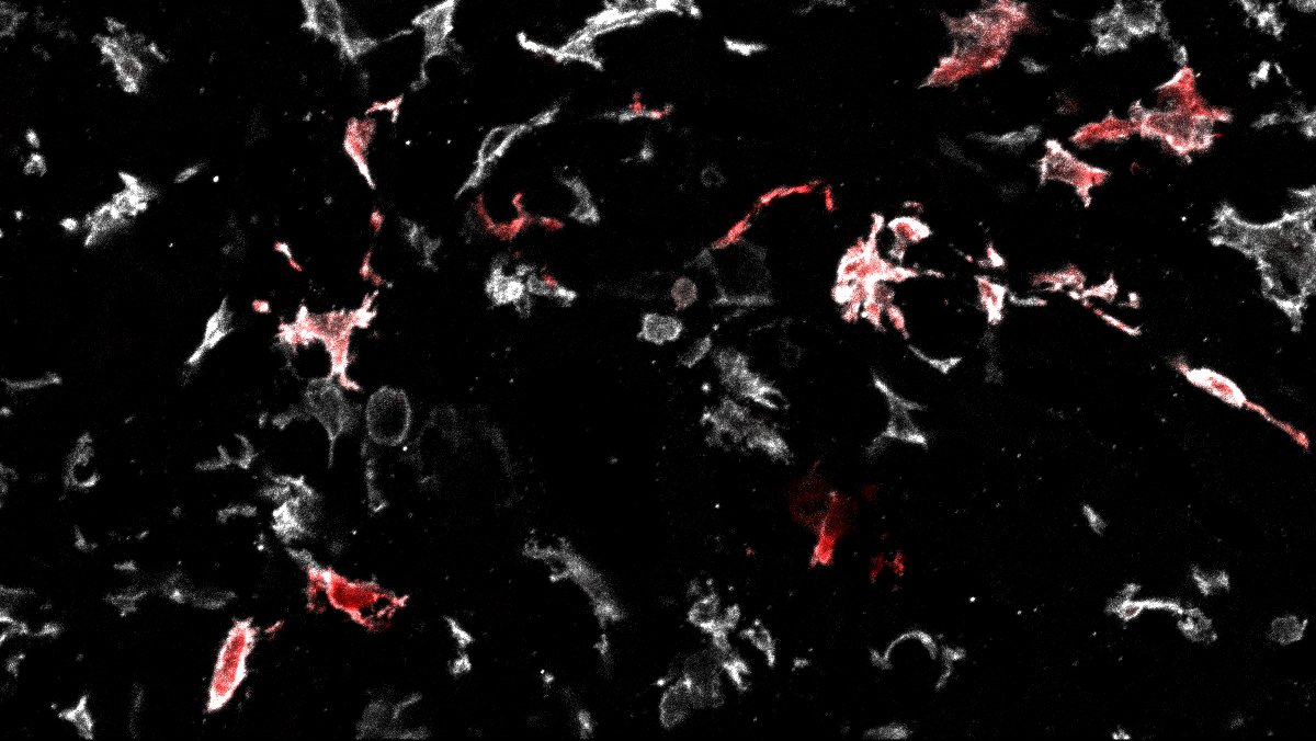 Embryonic-derived macrophages join the party of evil when seats are available
