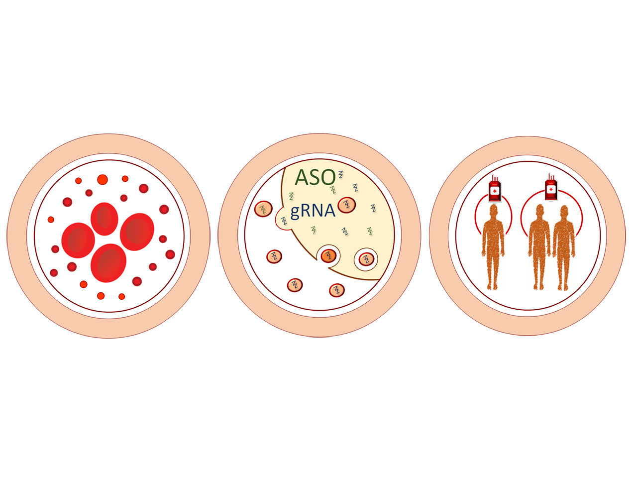 Harnessing red blood cell vesicles for gene therapies