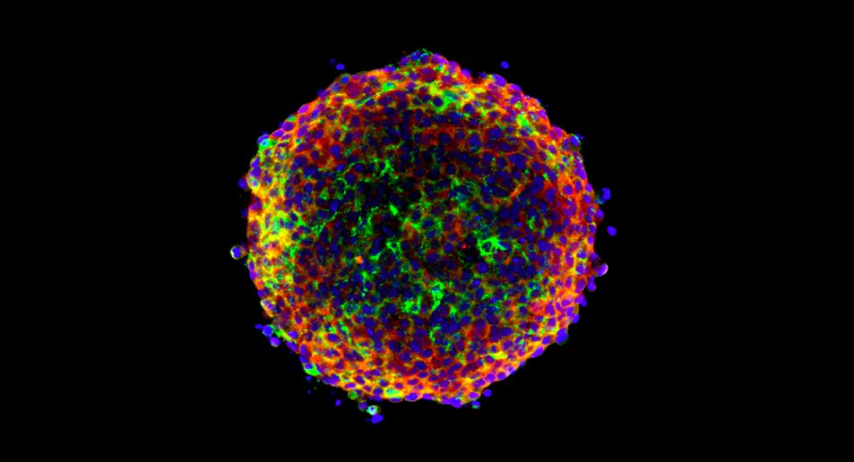 Inhibition of TGF-β signaling, invasion, and growth of cutaneous squamous cell carcinoma by PLX8394