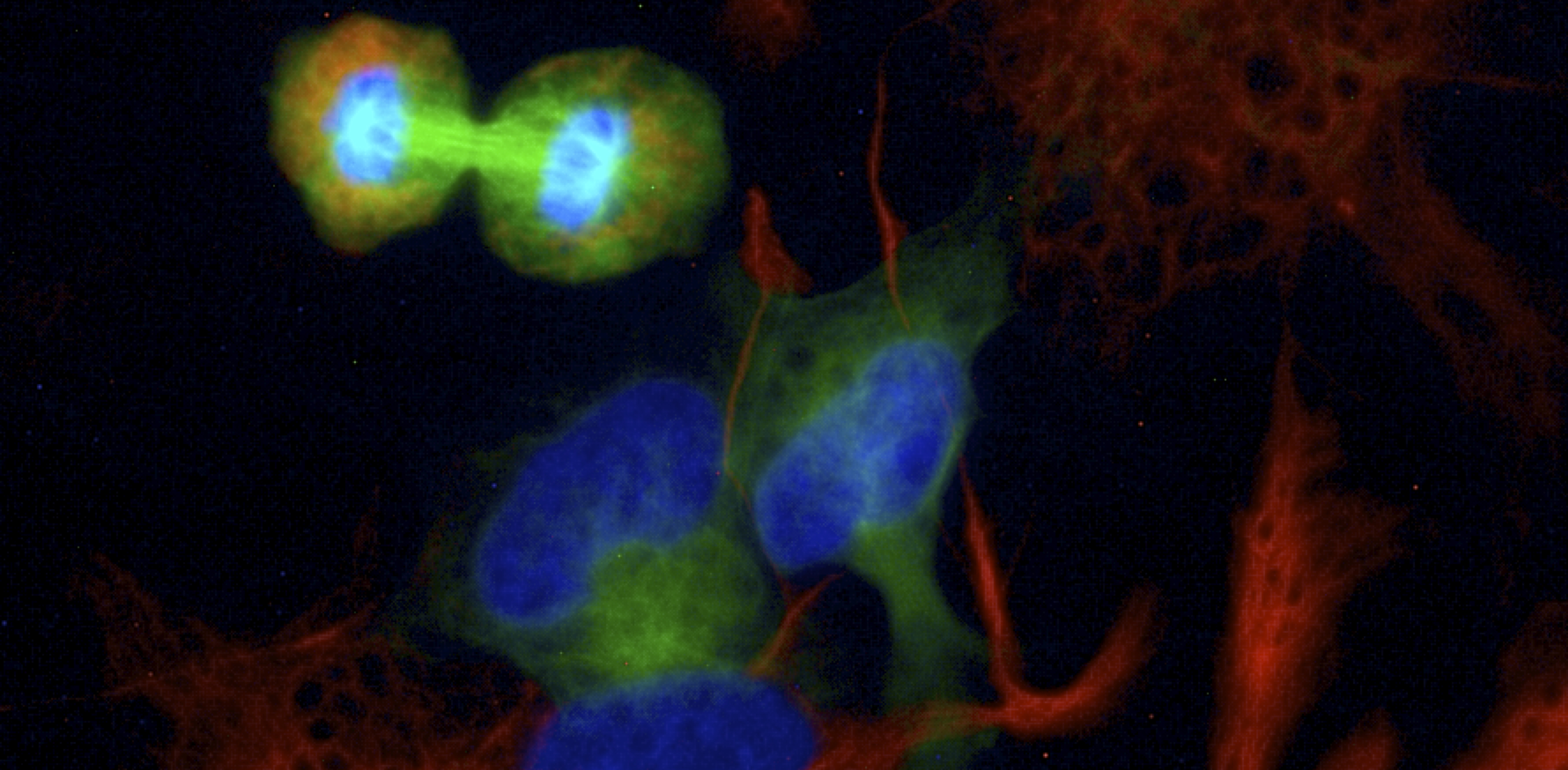 C1q-BAI1 signaling — a neural stem cell traffic light