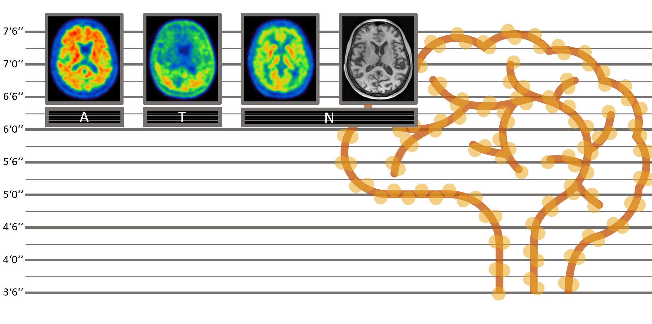 Wanted: Driving Force of Neuroinflammation
