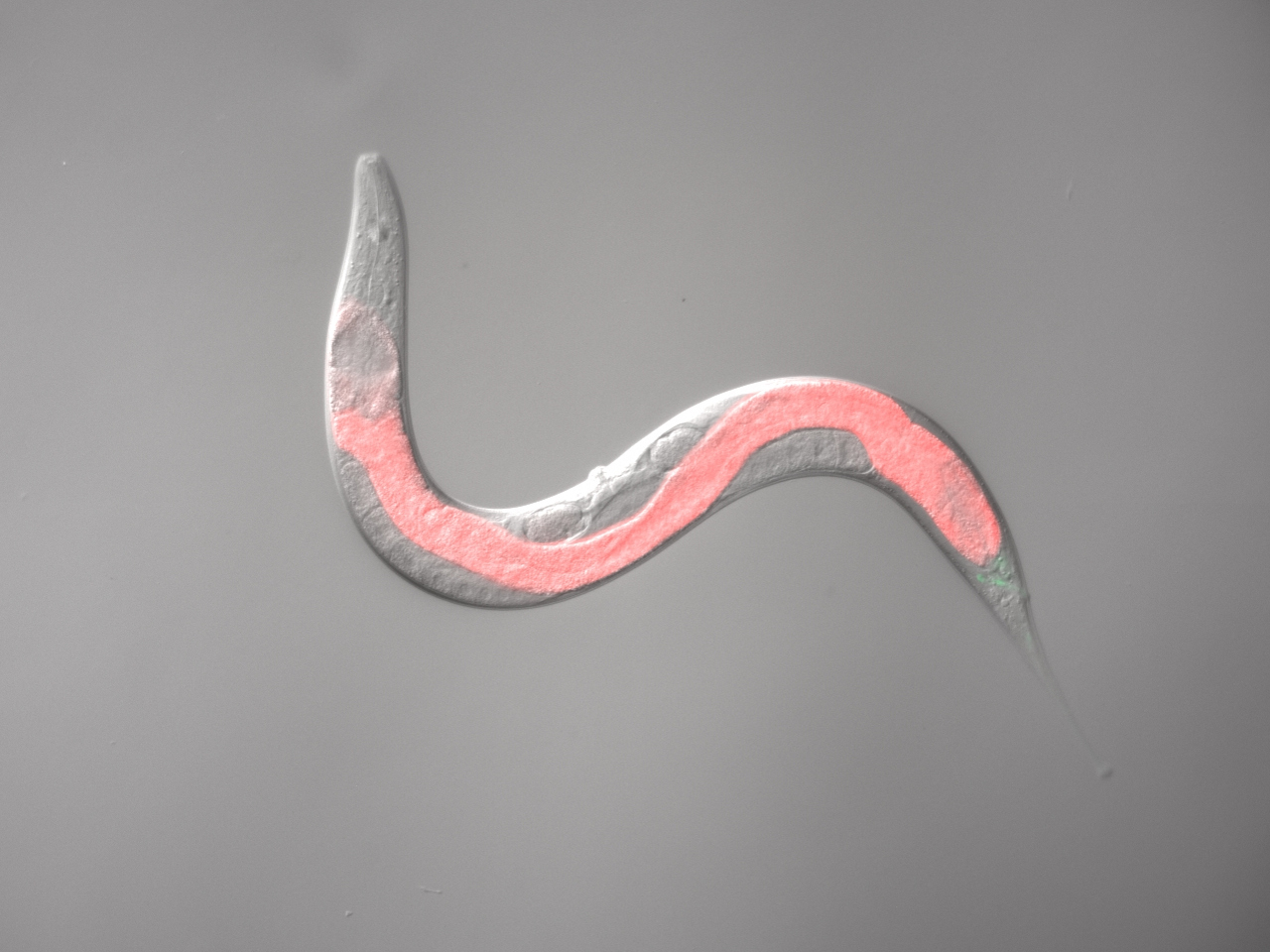 A few microns from the gut to the brain