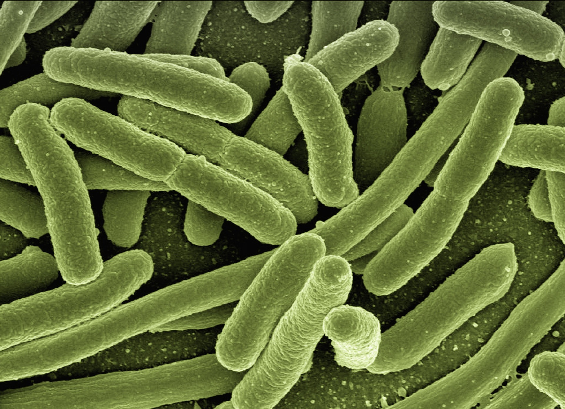 Bugs and guts in primary sclerosing cholangitis: The history of the factor X
