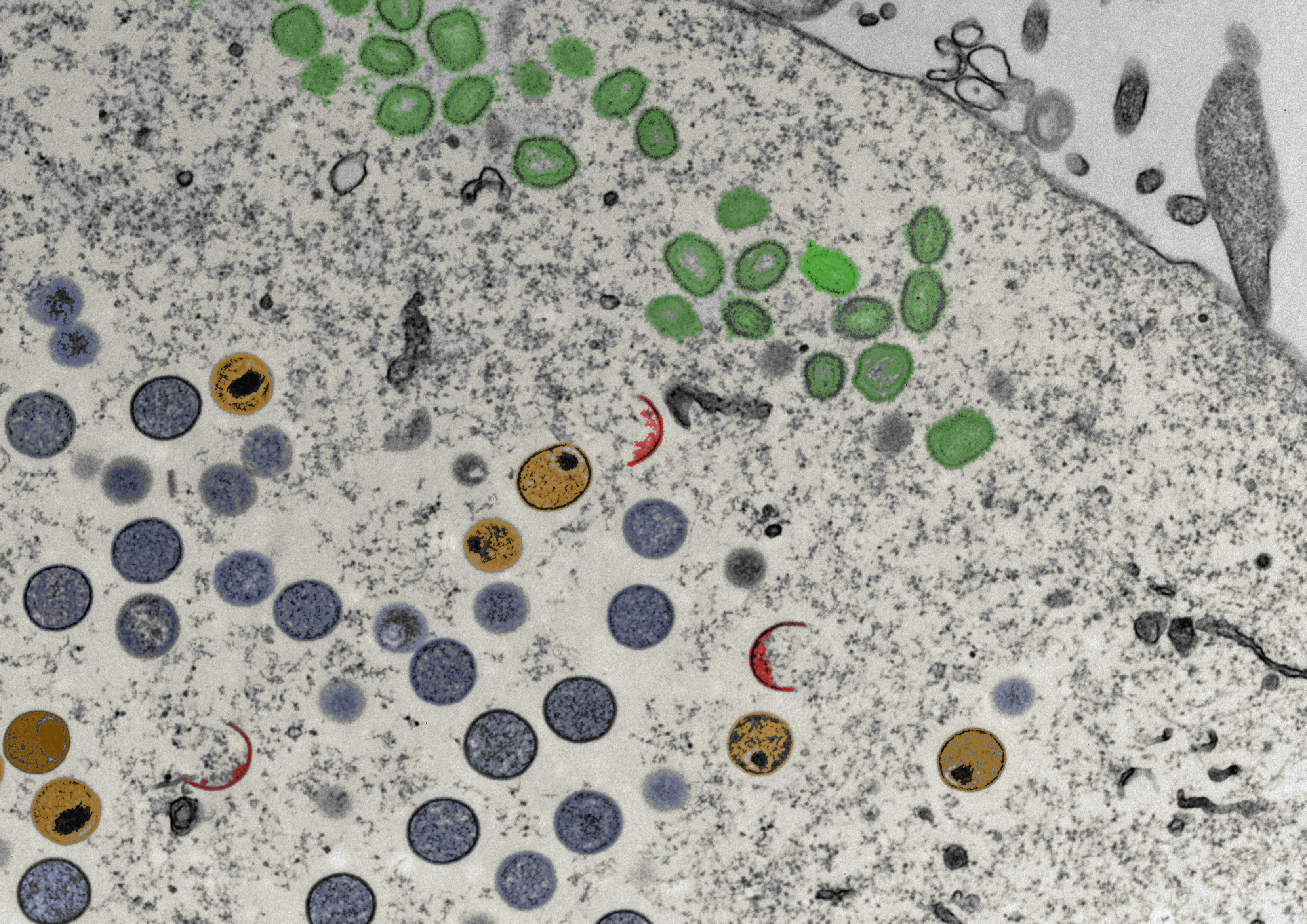 Vaccinia, mass spectrometry and electron microscopy: It takes three to tango.