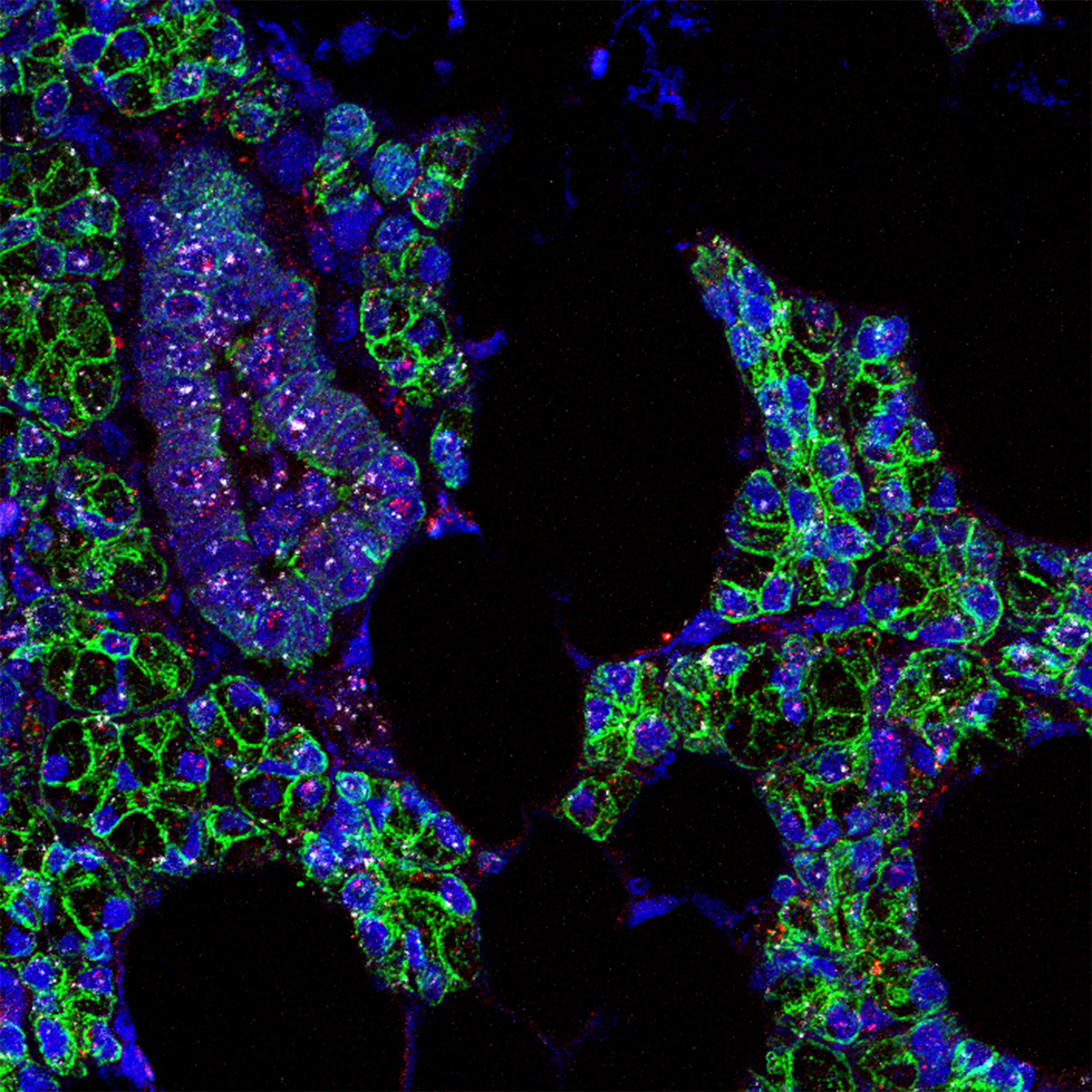 Responding to the COVID-19 Pandemic: The Mouth Is a Site of SARS-CoV-2 Infection