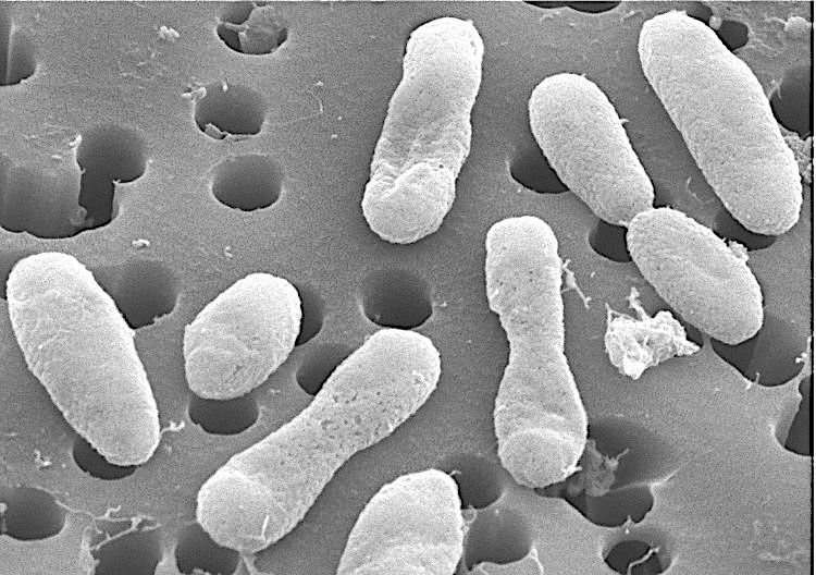 Behind an evolutionary timeline of Alphaproteobacteria
