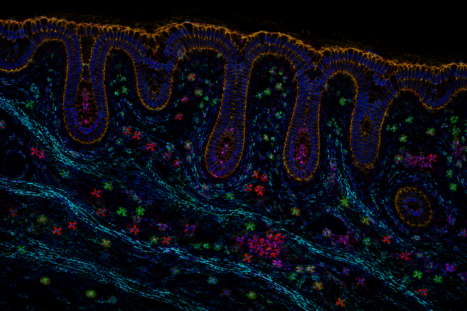 The Future of Oncology: From Detection to Interception