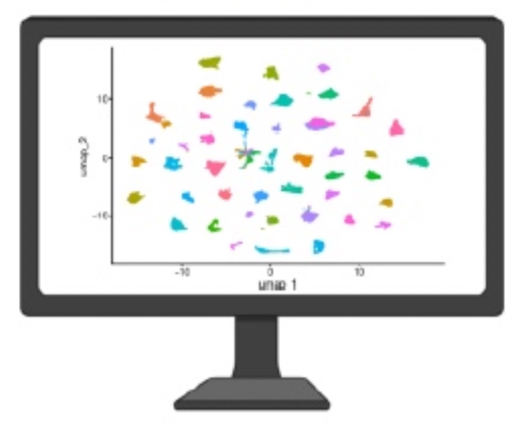 A single-cell view of pancreatic cancer diversity