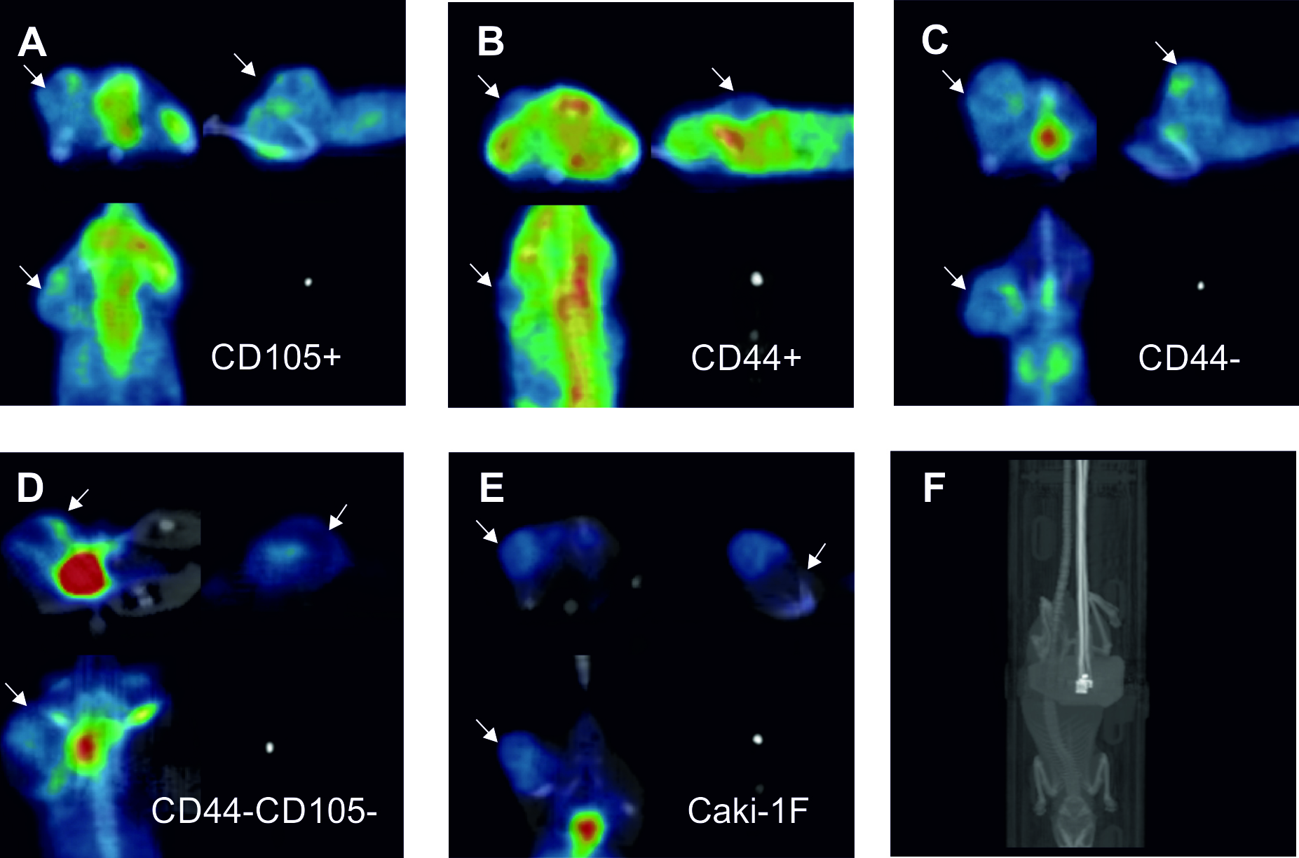 Looking for cancer stem cells signature in renal cancer cells