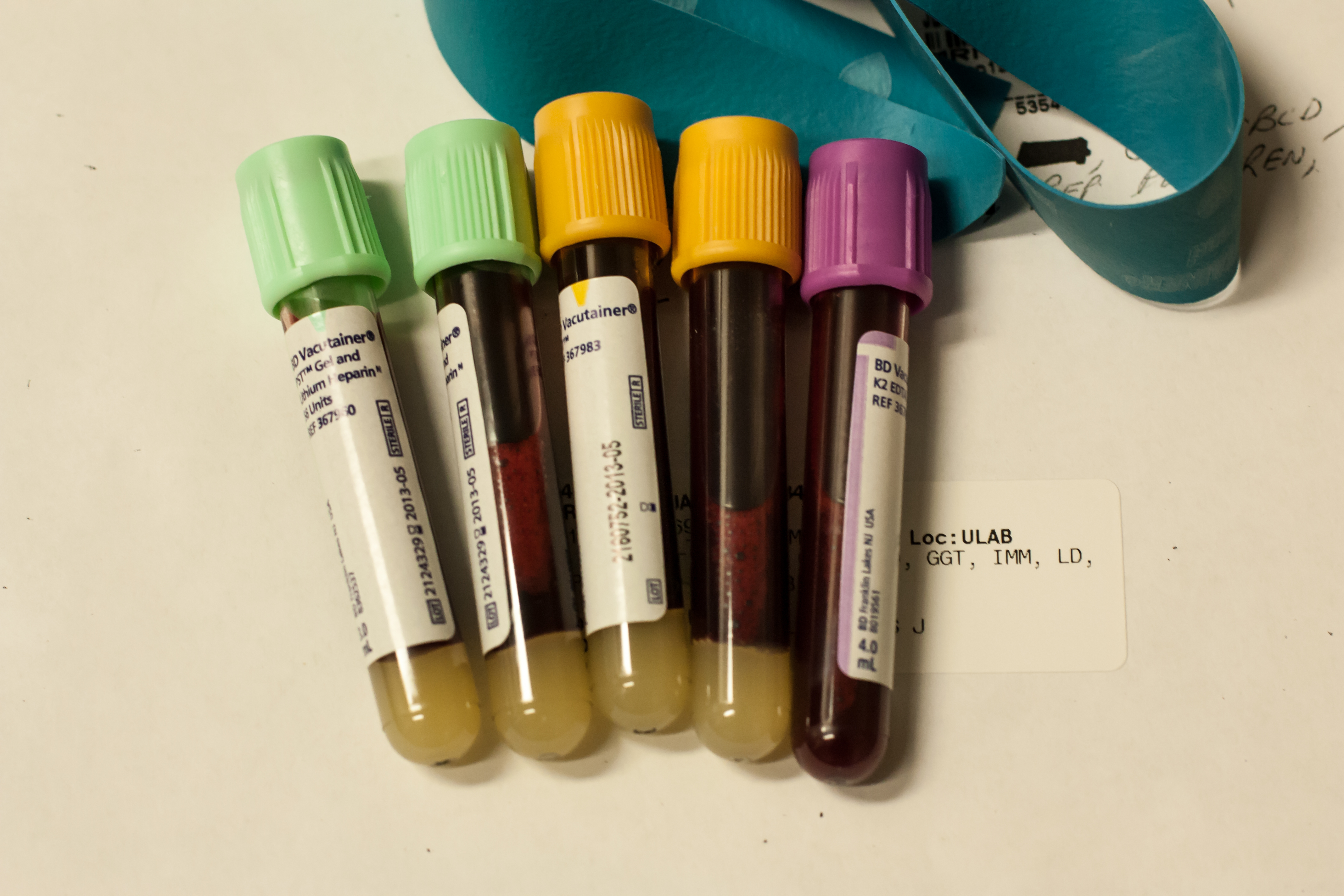 Identifying mutational signatures in circulating cell-free DNA