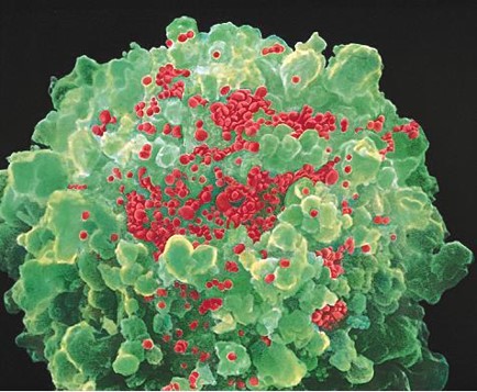 After the Paper: HIV knocks on the door