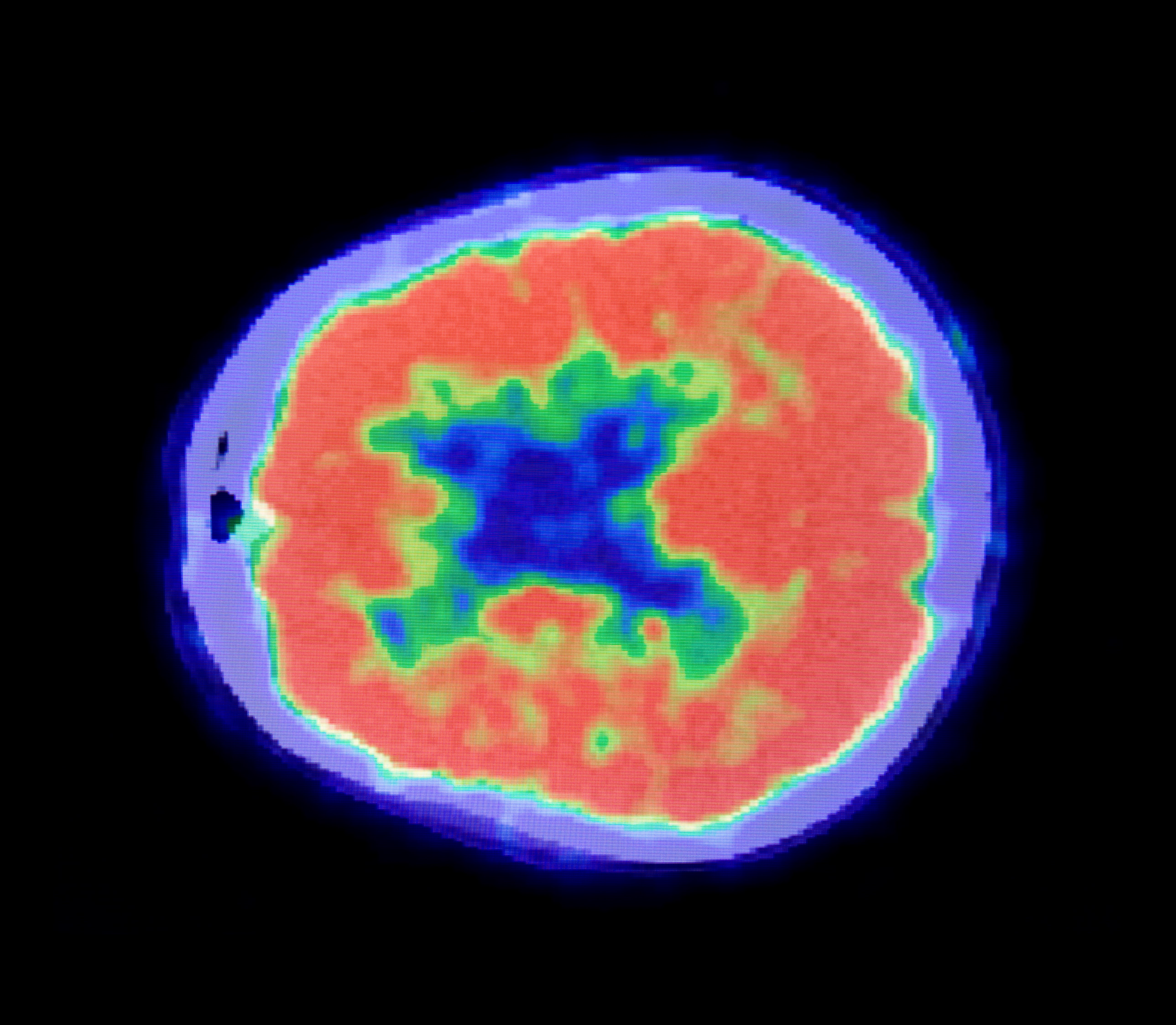 Top 100 of 2024 in Cancer| Scientific Reports