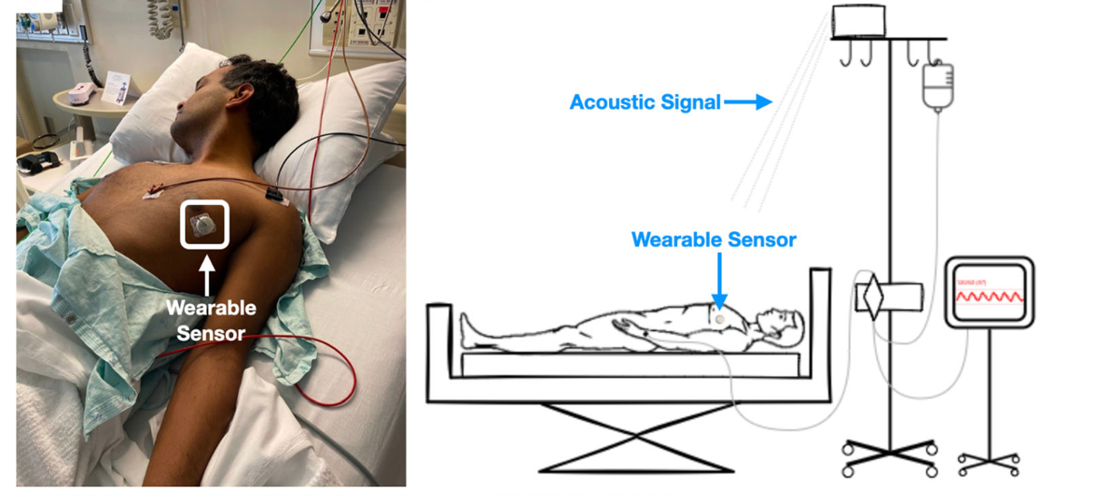 Wearable device that corrects arterial blood pressure readings 