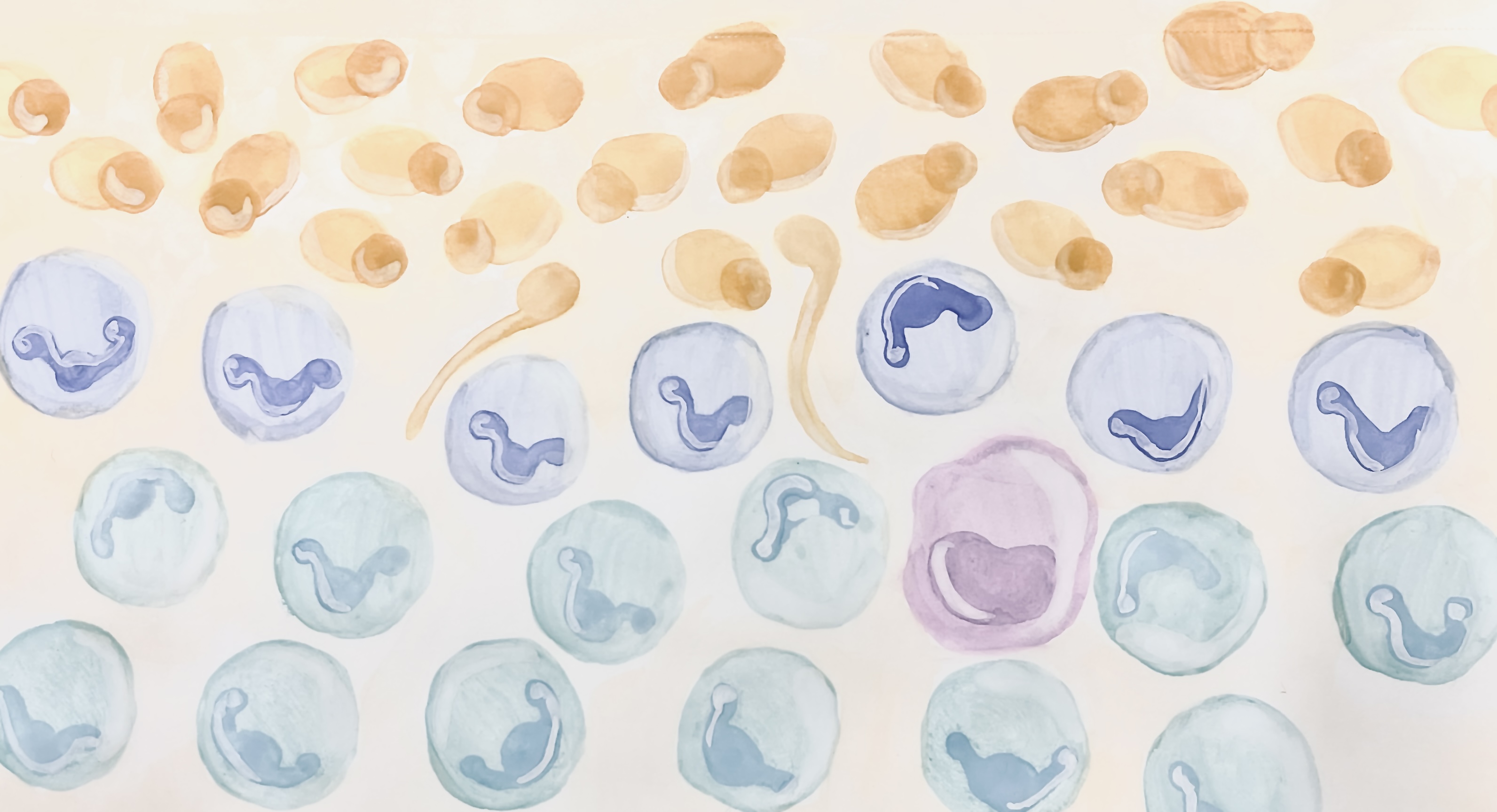Lack of TYK2 Signaling Enhances Host Resistance to Candida albicans Skin Infection