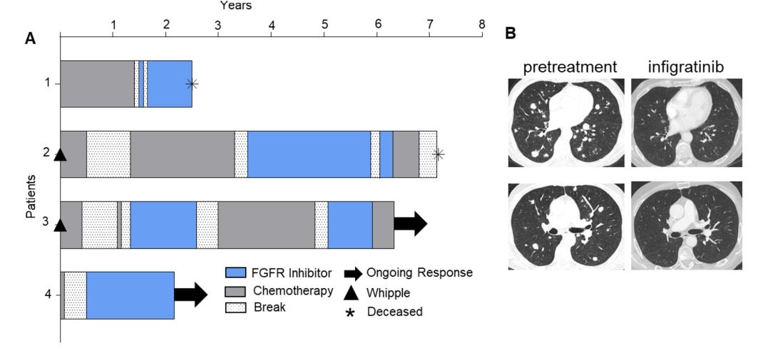 Uncovering a new precision medicine target in pancreatic cancer 
