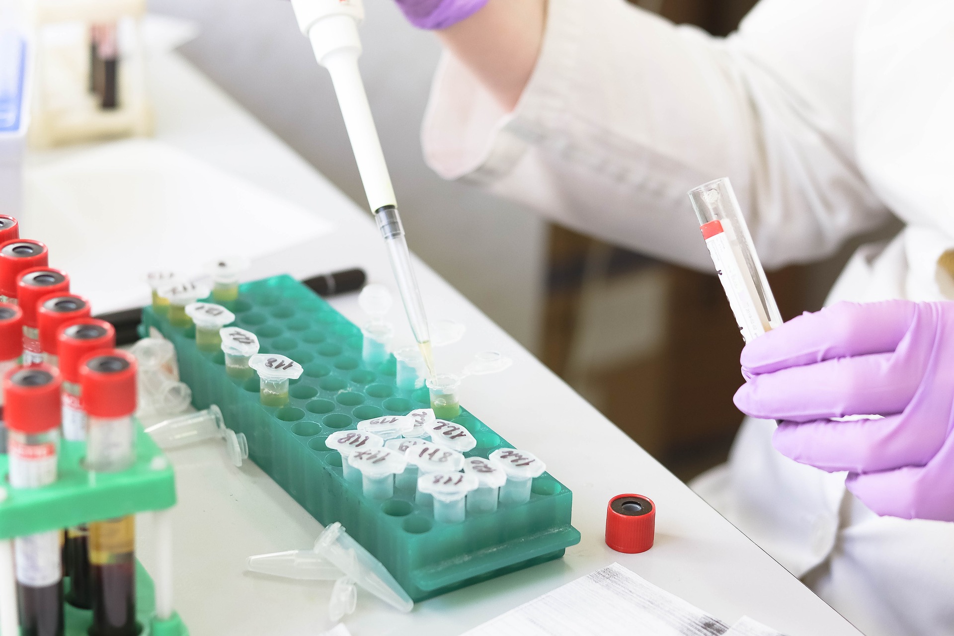 Predicting infectious SARS-CoV-2 from diagnostic samples