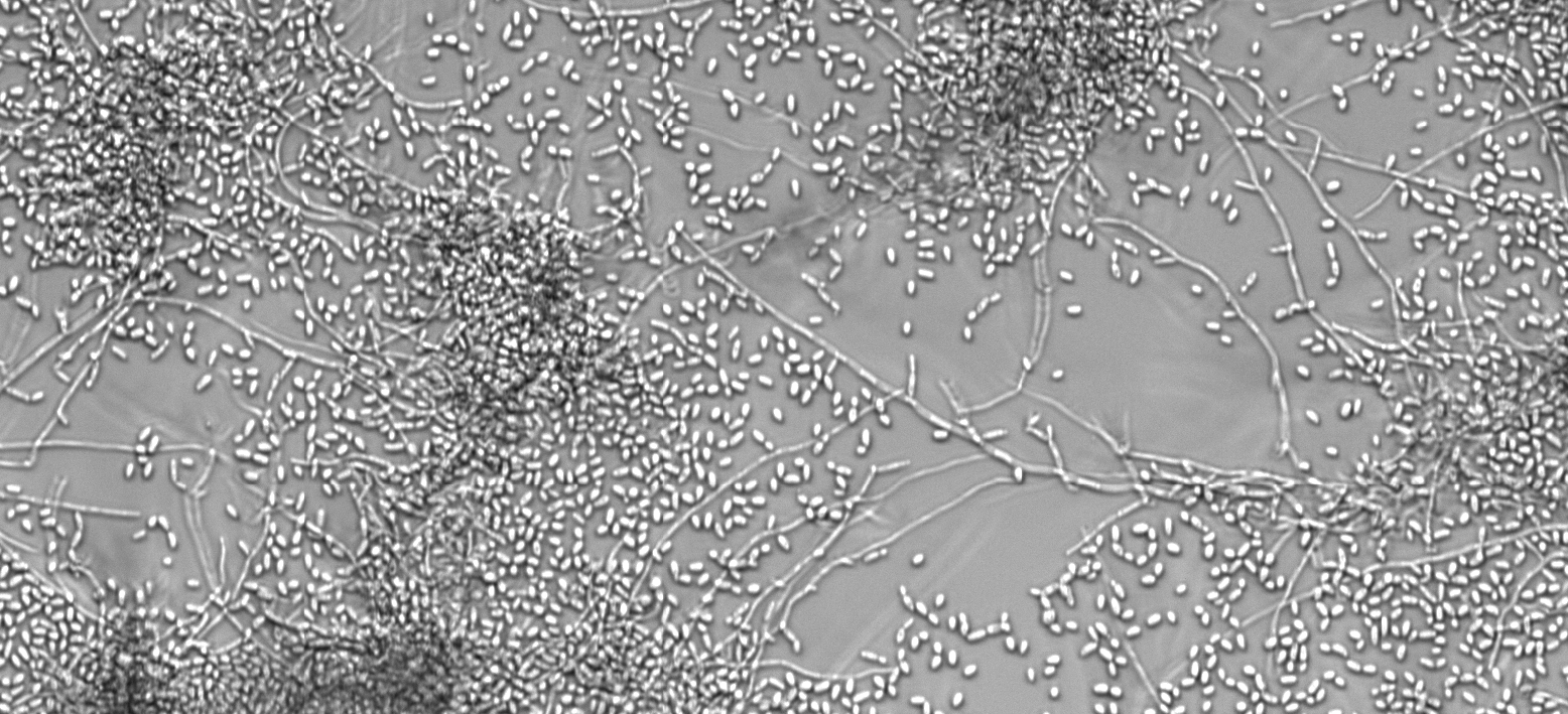 Understanding how bacterial colonisation antagonizes a pathogenic fungus: metabolites matter 