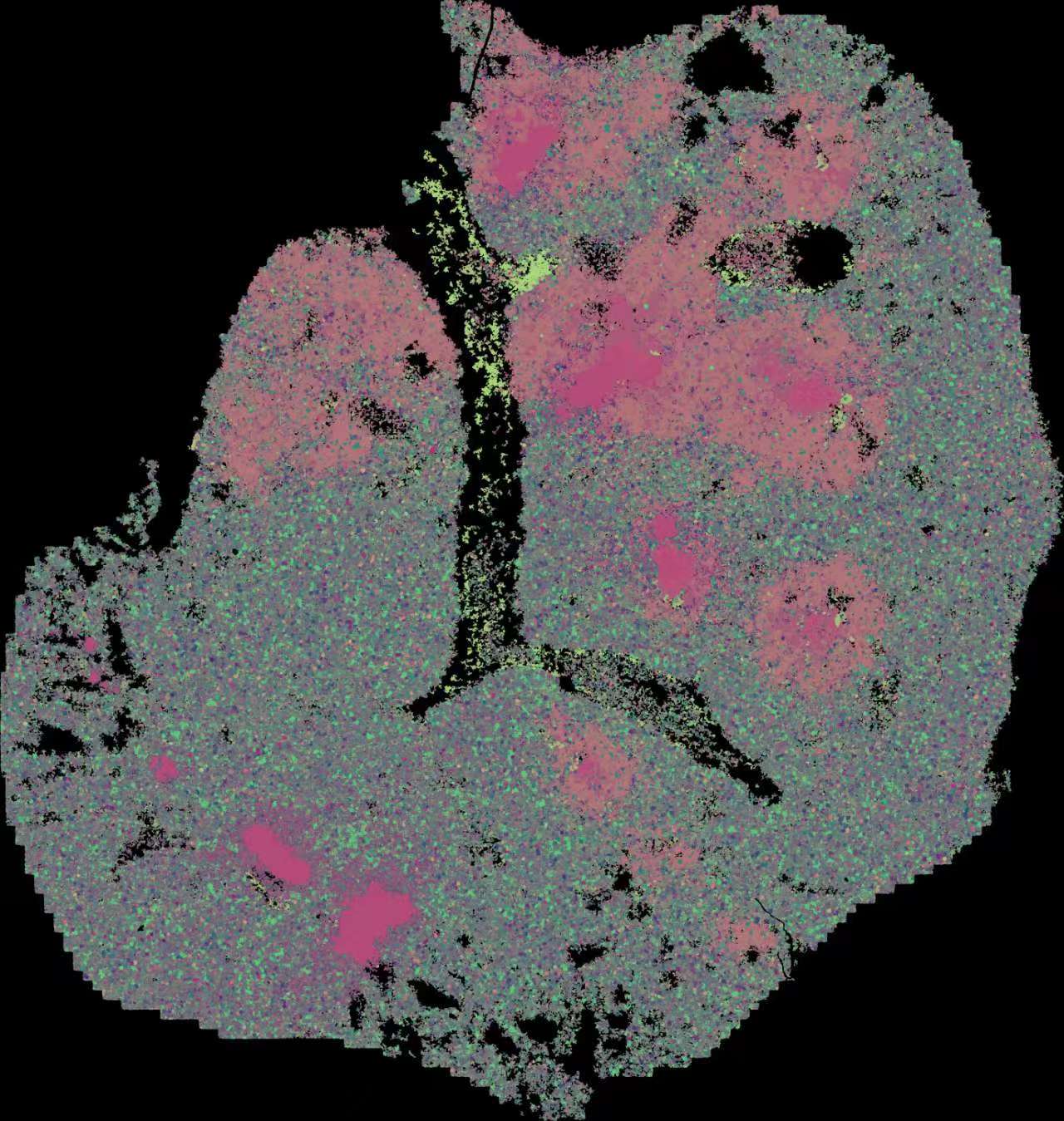 Alveolar dendritic cell–T cell immunity hubs defending against pulmonary infection