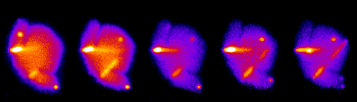 Size matters: supersized bacterial secretion system