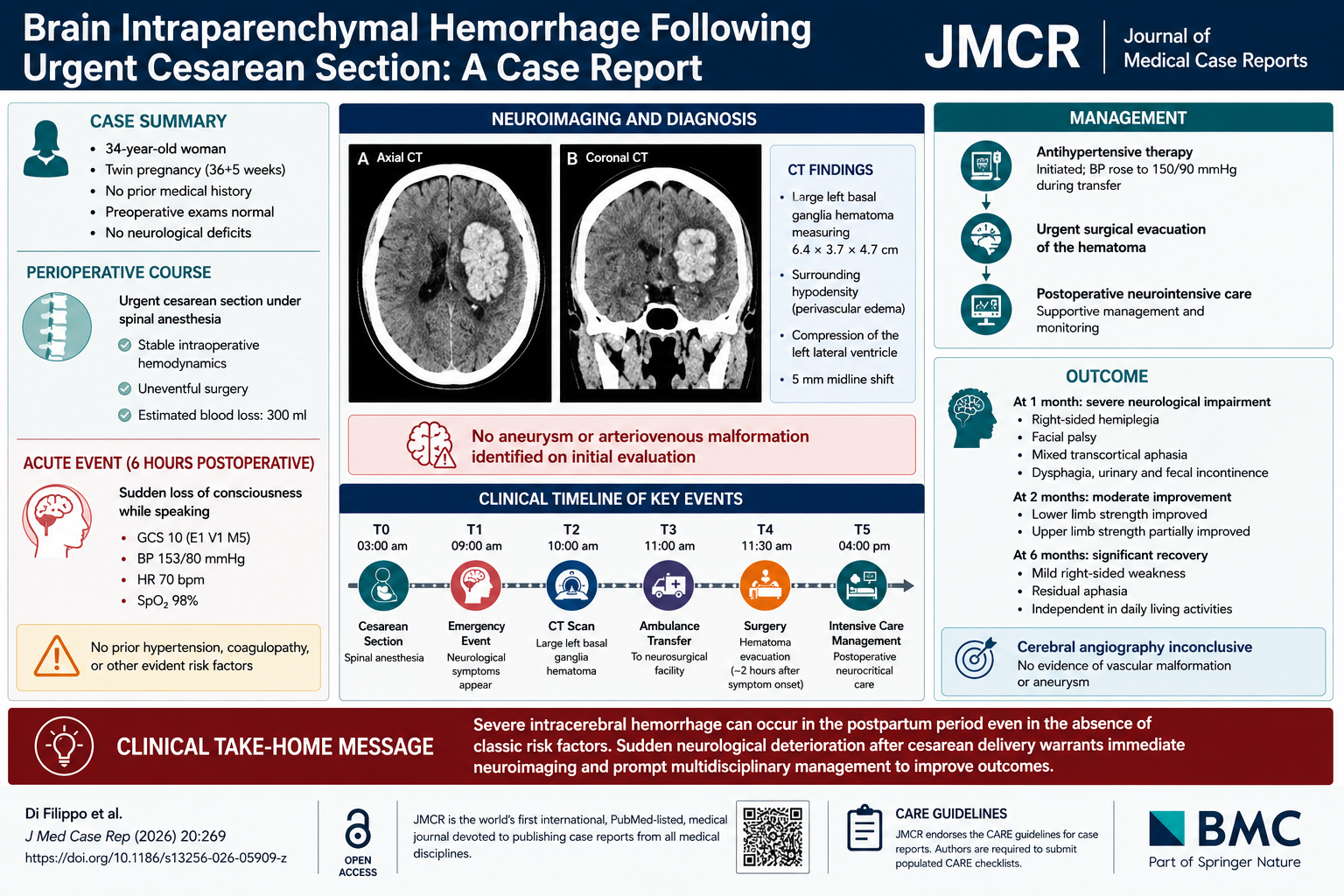 Postpartum Basal Ganglia Hemorrhage After Cesarean Section Under Spinal Anesthesia: A Rare Neurological Emergency