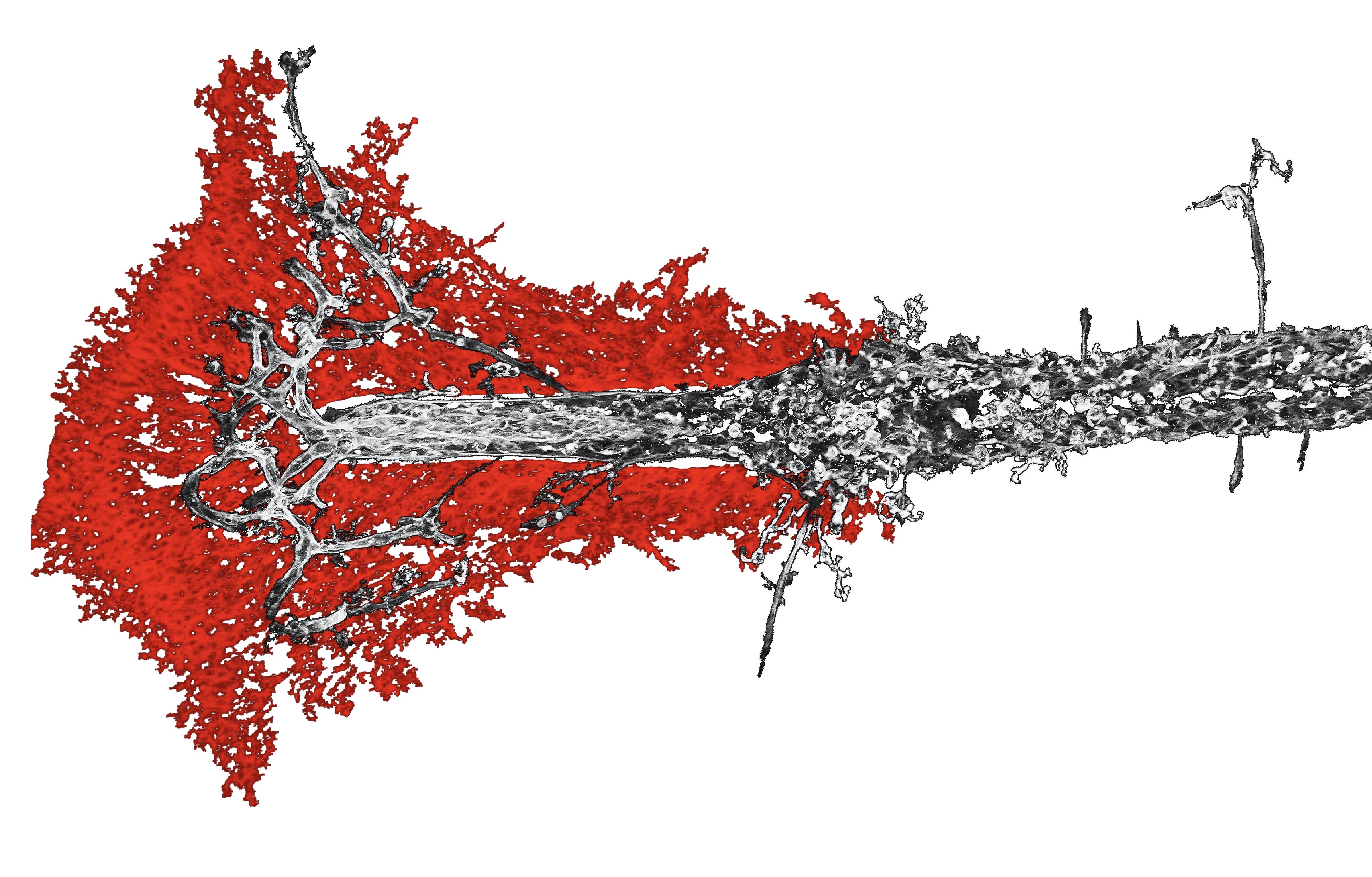 Building a bridge: how the two hemispheres of the brain connect during development.