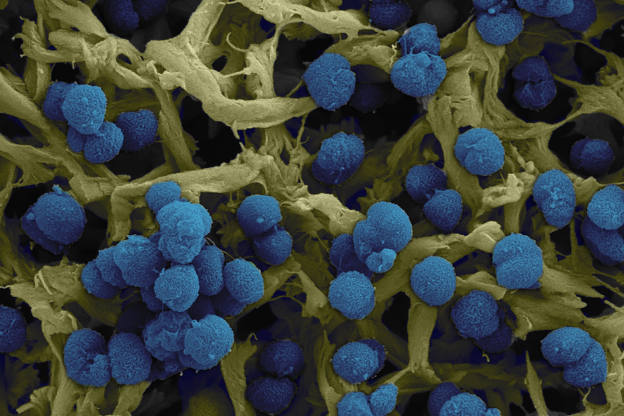 The scavenger inside your nose