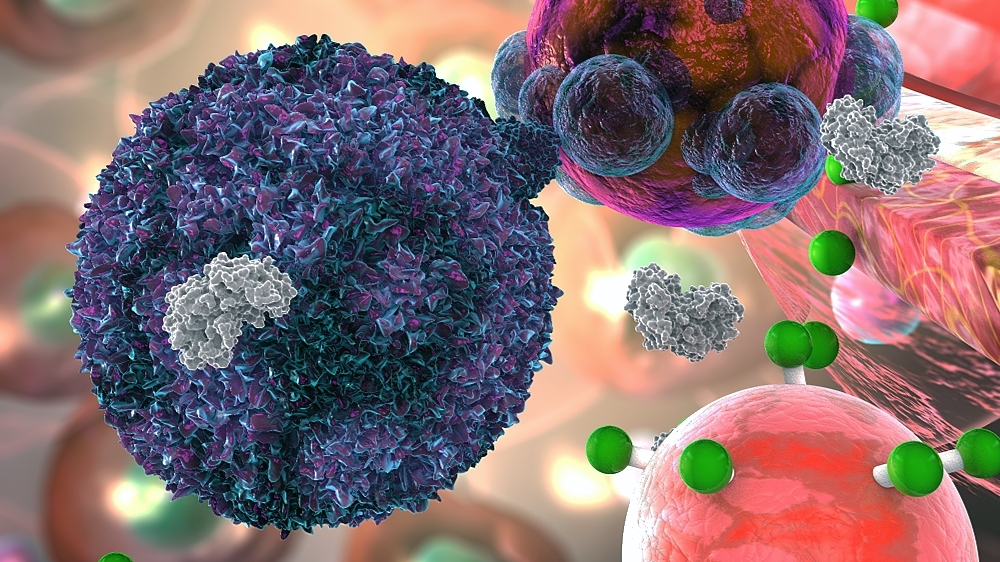 Immune activity sensors for noninvasive and early detection of acute transplant rejection