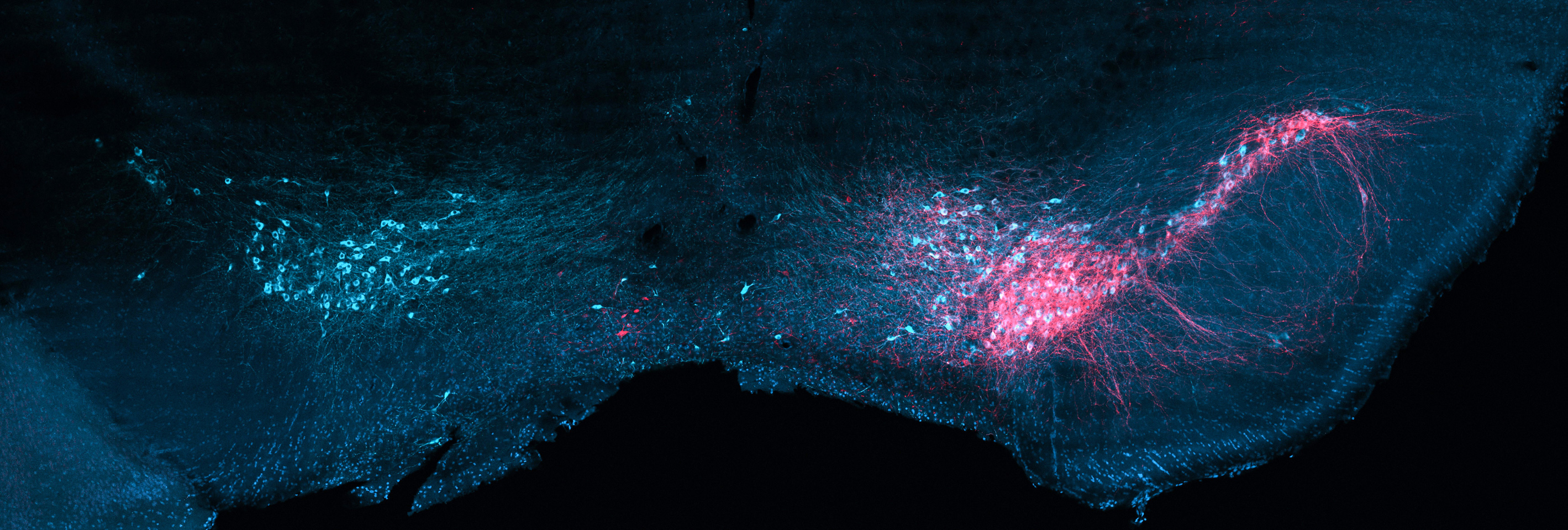 Controlling selected brain circuits with ultrasound-targeted gene therapy