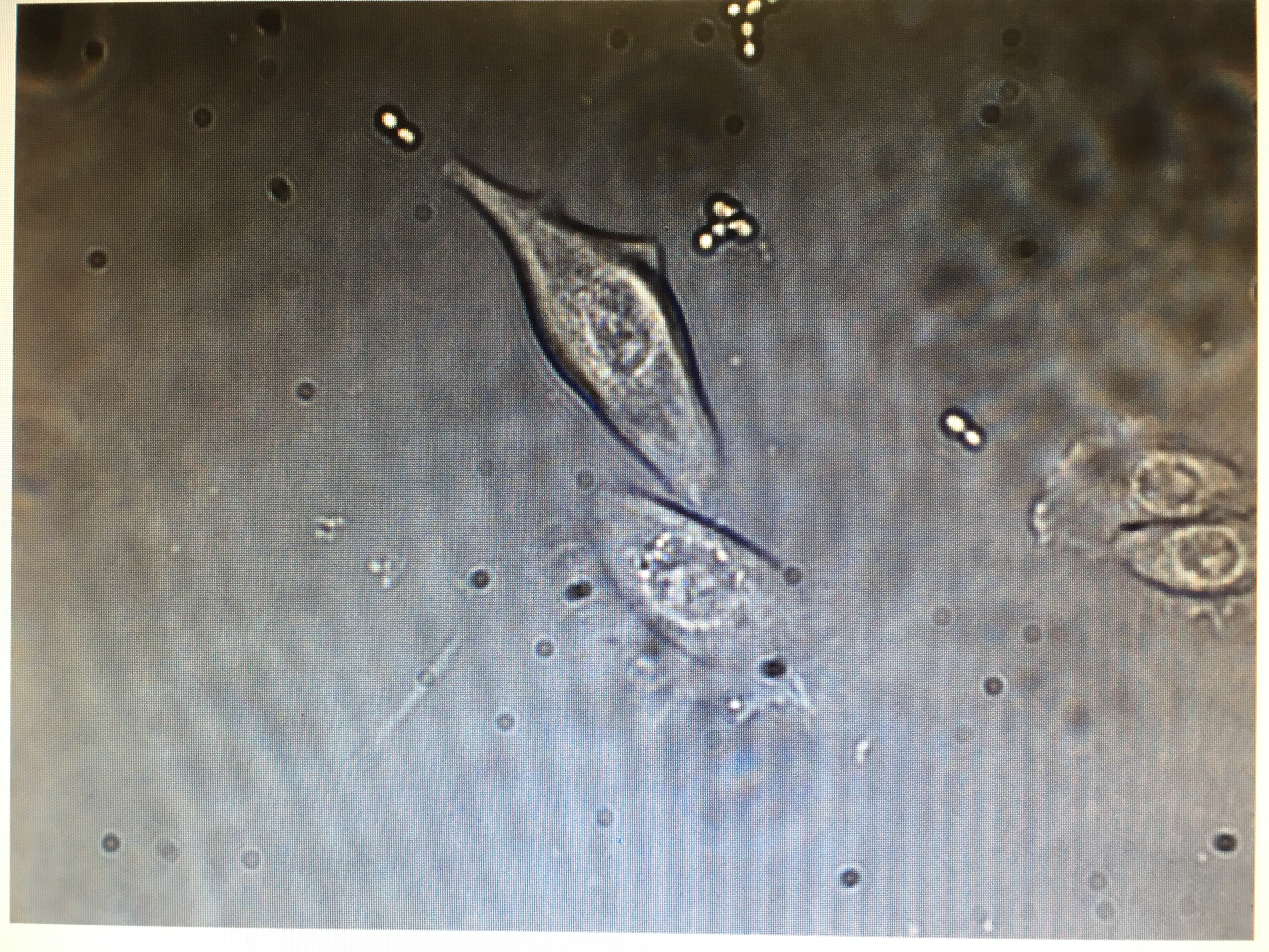 A very close look into the molecular basis of adhesion and biofilm establishment by Candida glabrata