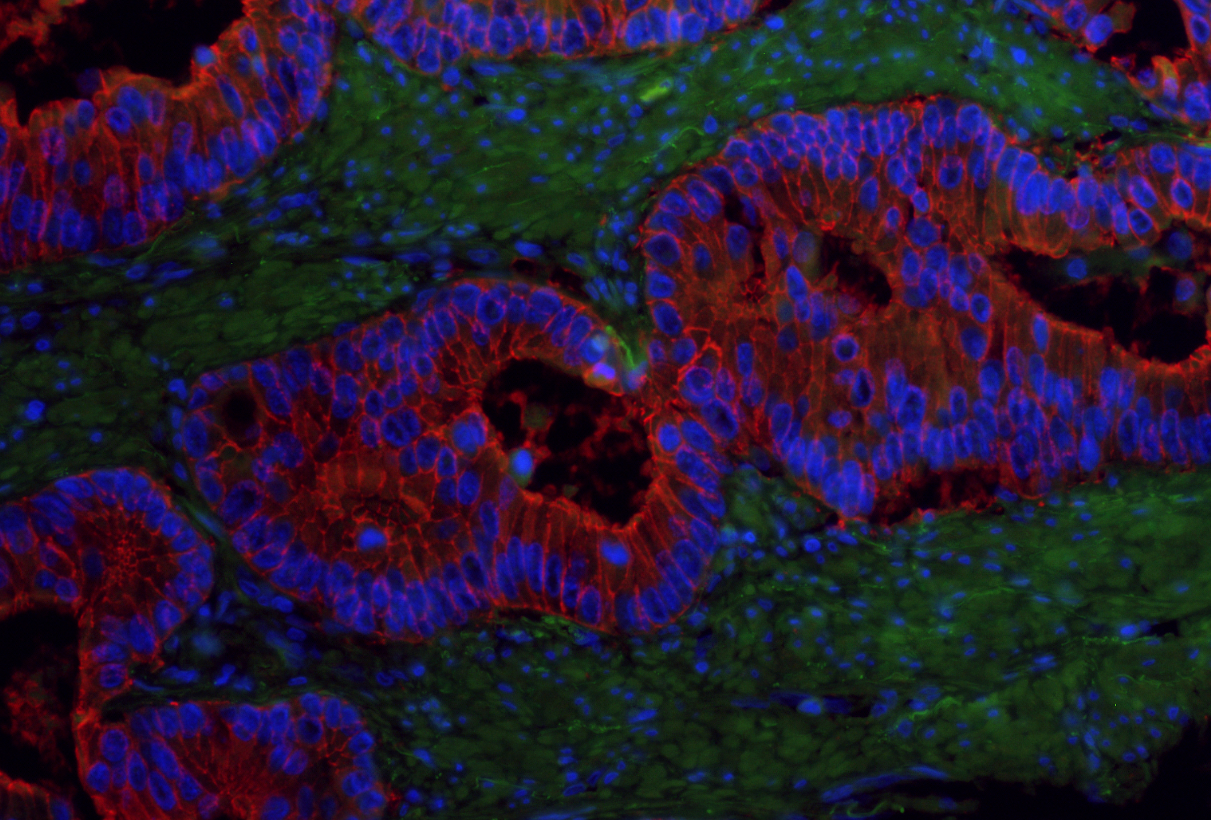 Establishing a link between G9a activity and pluripotency in colorectal cancer stem cells