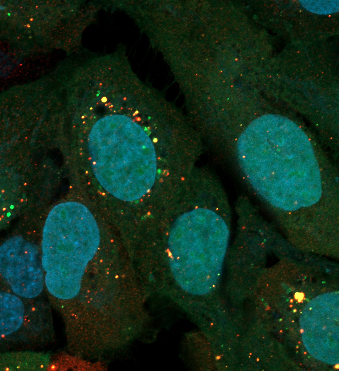 Special Issue on Autophagy: From yeast to humans