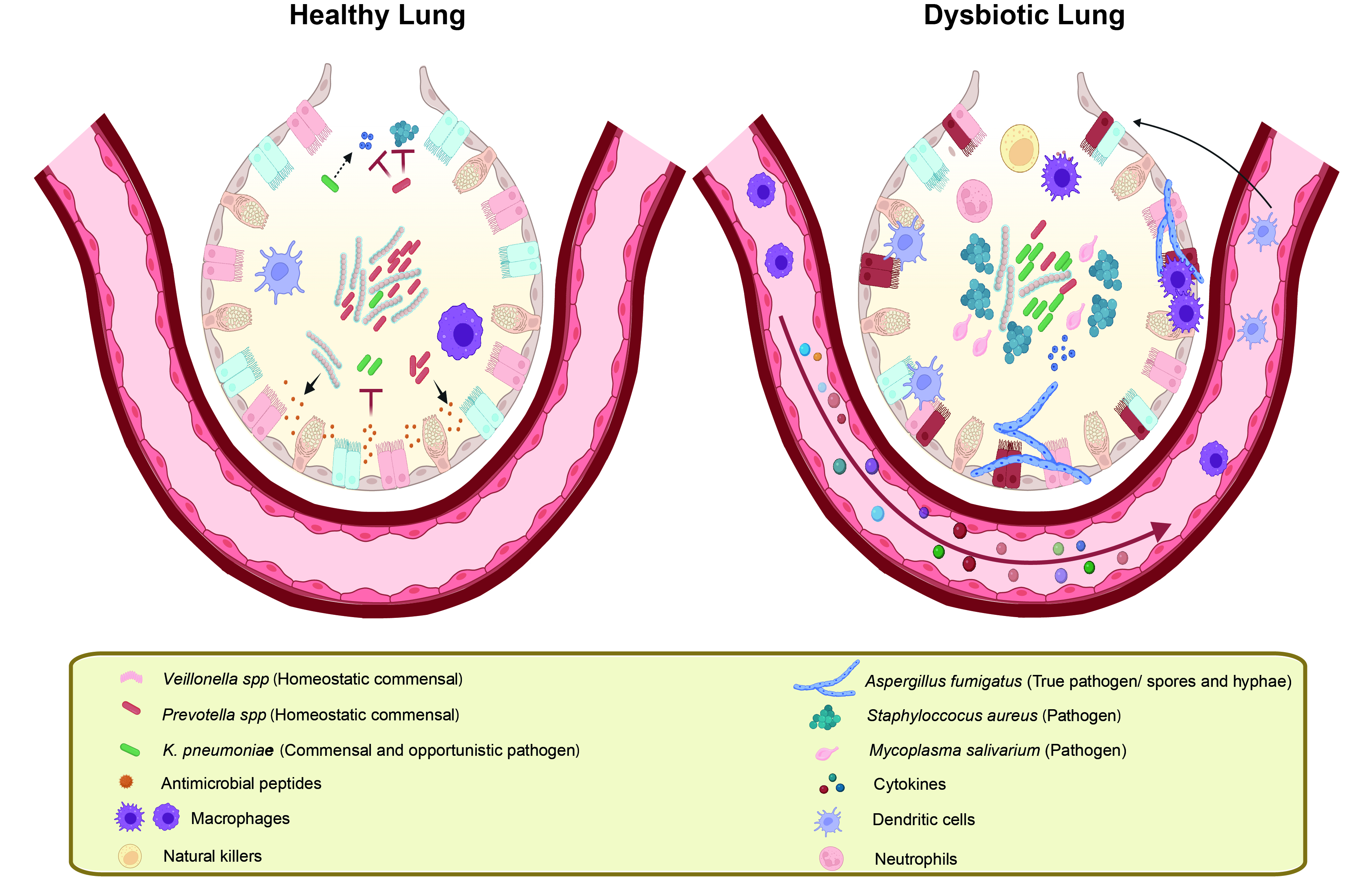 Polymicrobial Infections – A Life-Long Tug of War between Immunity and Pathogens
