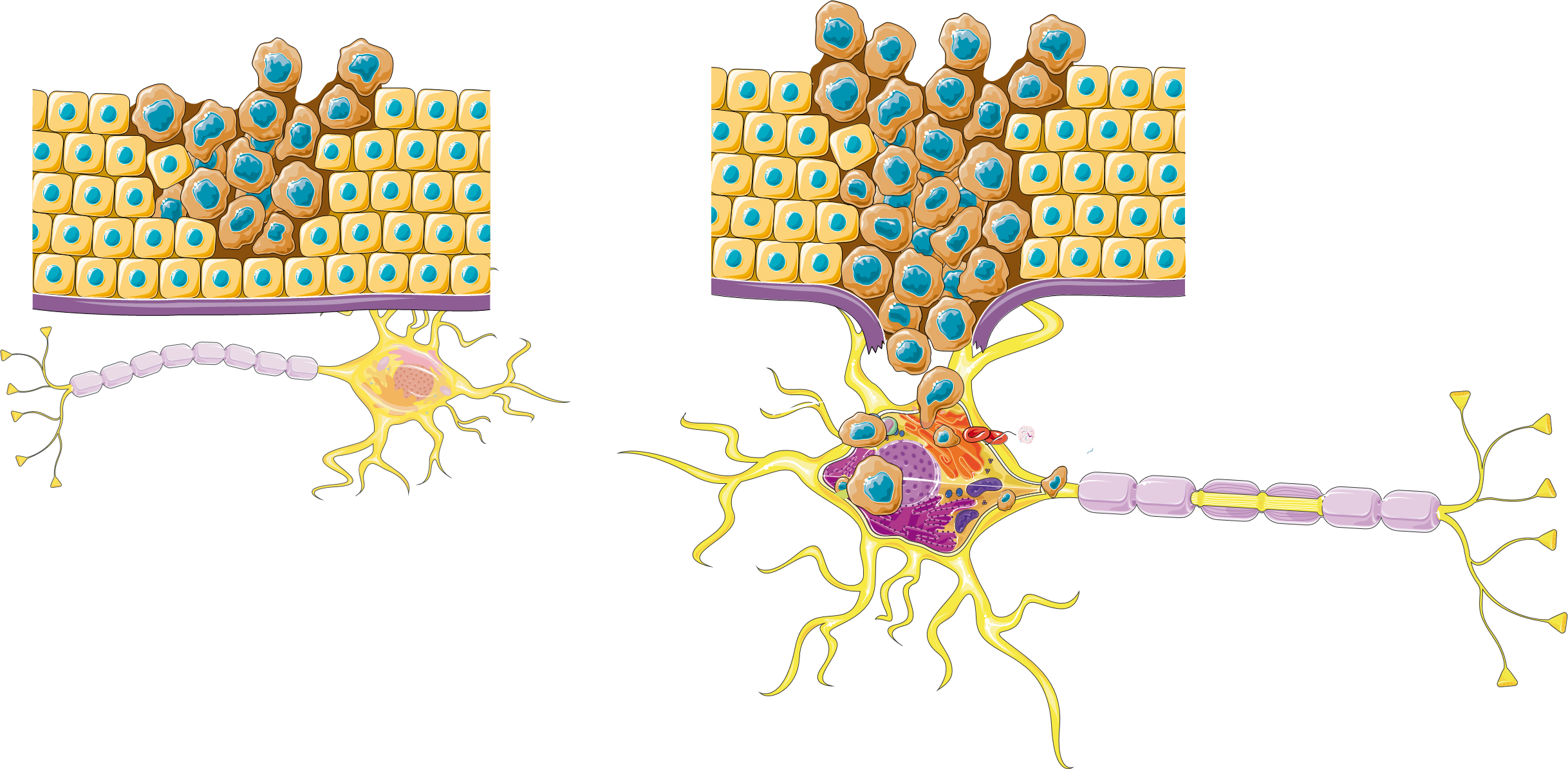 Nerve Fibres in the Tumour Microenvironment