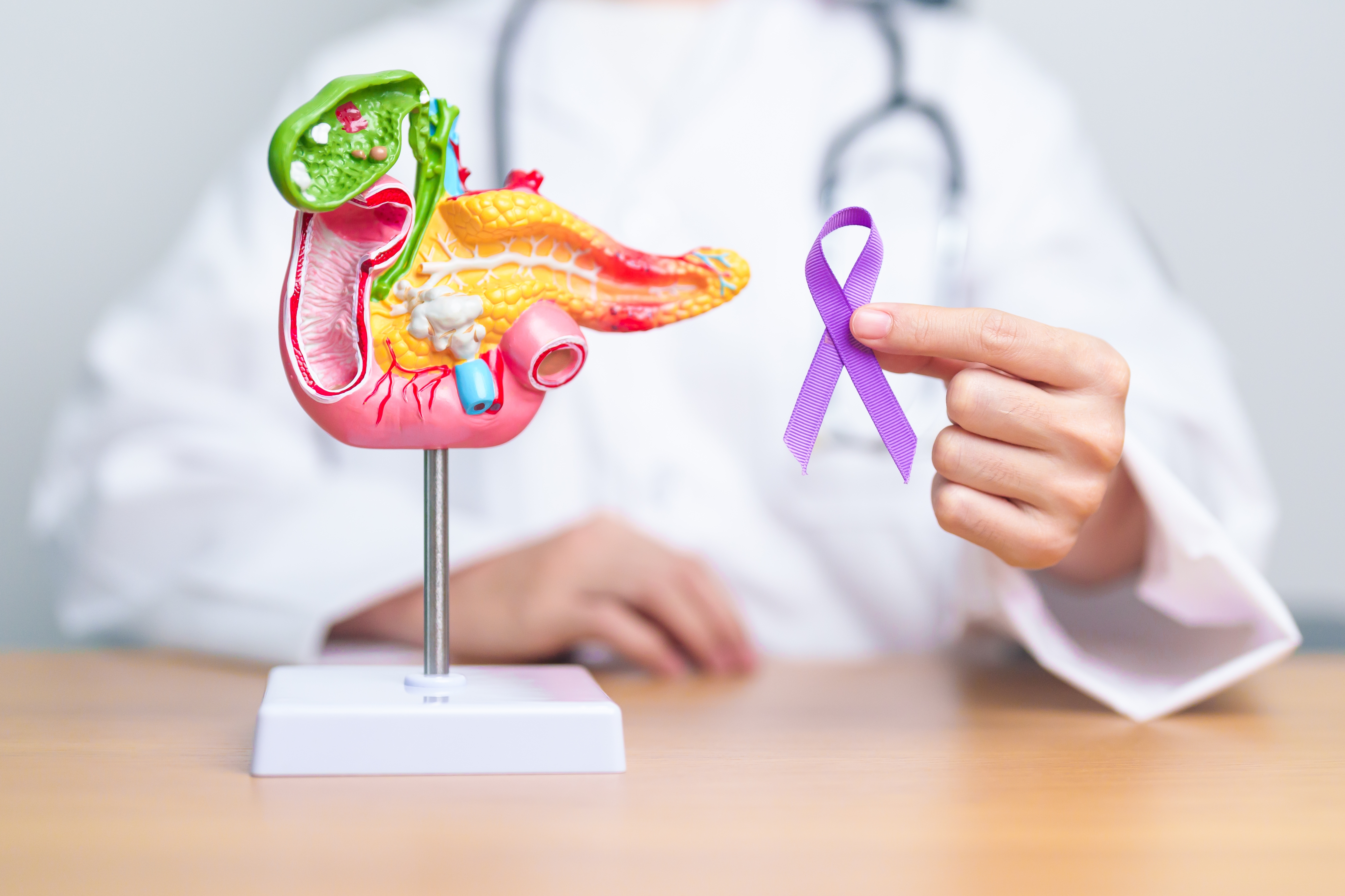 Personalized Care for Pancreatic Cancer: Harnessing Patient-Derived Organoids
