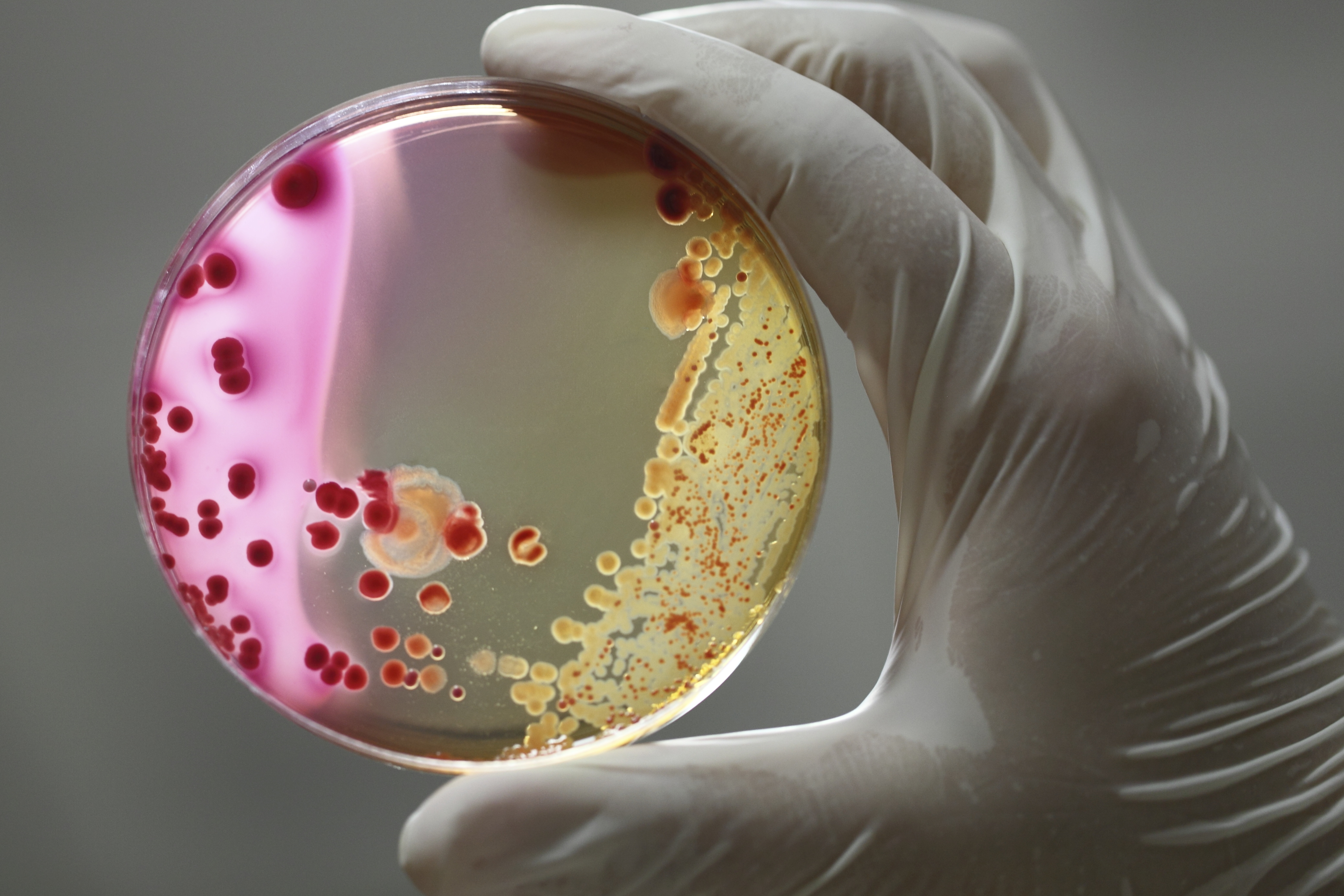Journal Club: Resistant carbapenem-resistant bacteria is spreading in Europe