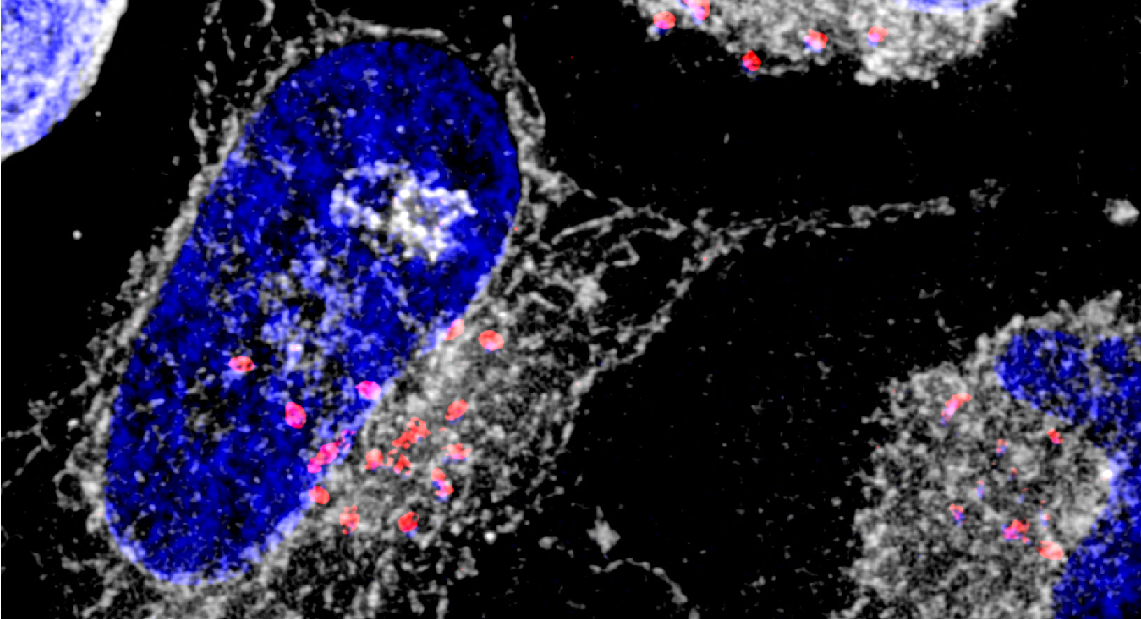 p53 under siege: A novel strategy of immune evasion by an intracellular pathogen