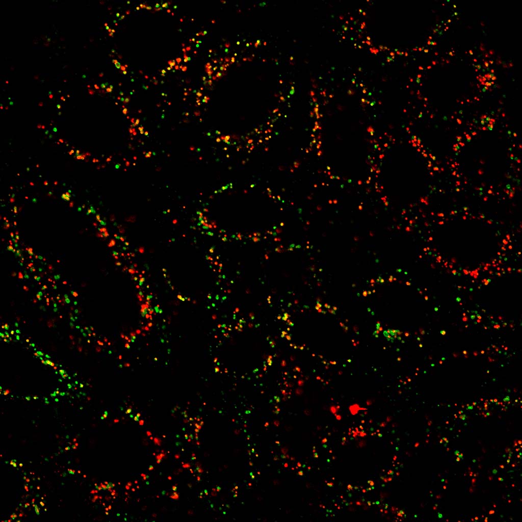 Phosphoglycerate kinase 1 acts as a cargo adaptor for EGFR lysosomal transport