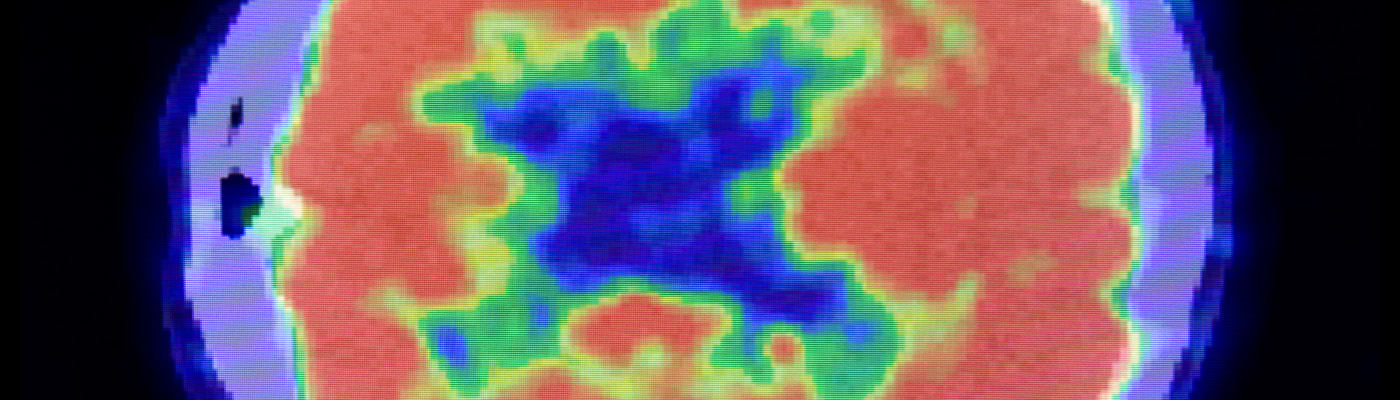 Radioisotopes and radiochemistry in health science 
