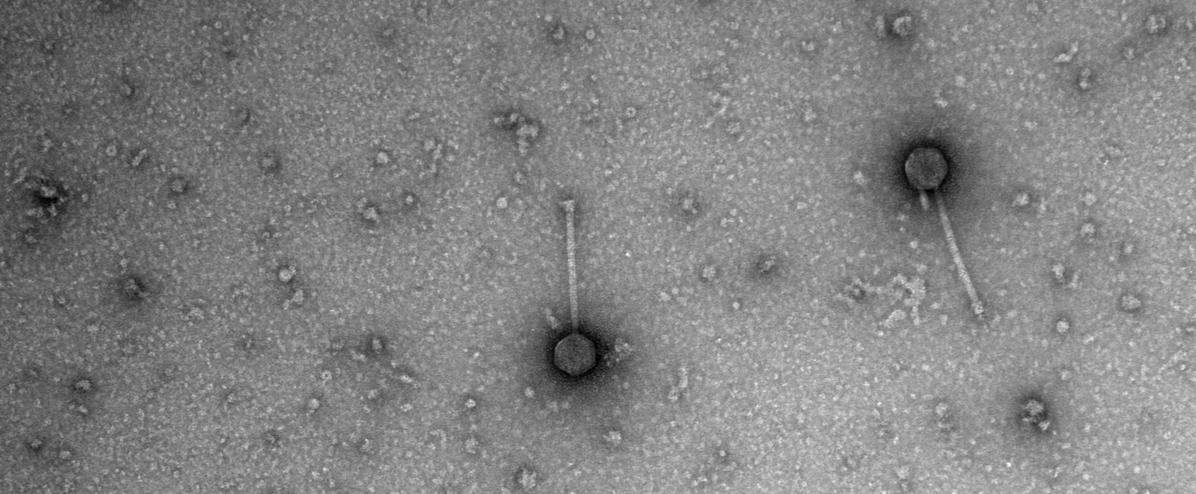 Finding Our Way to Phages: Single Bacteriophage Treatment of Disseminated Cutaneous Mycobacterium chelonae Infection