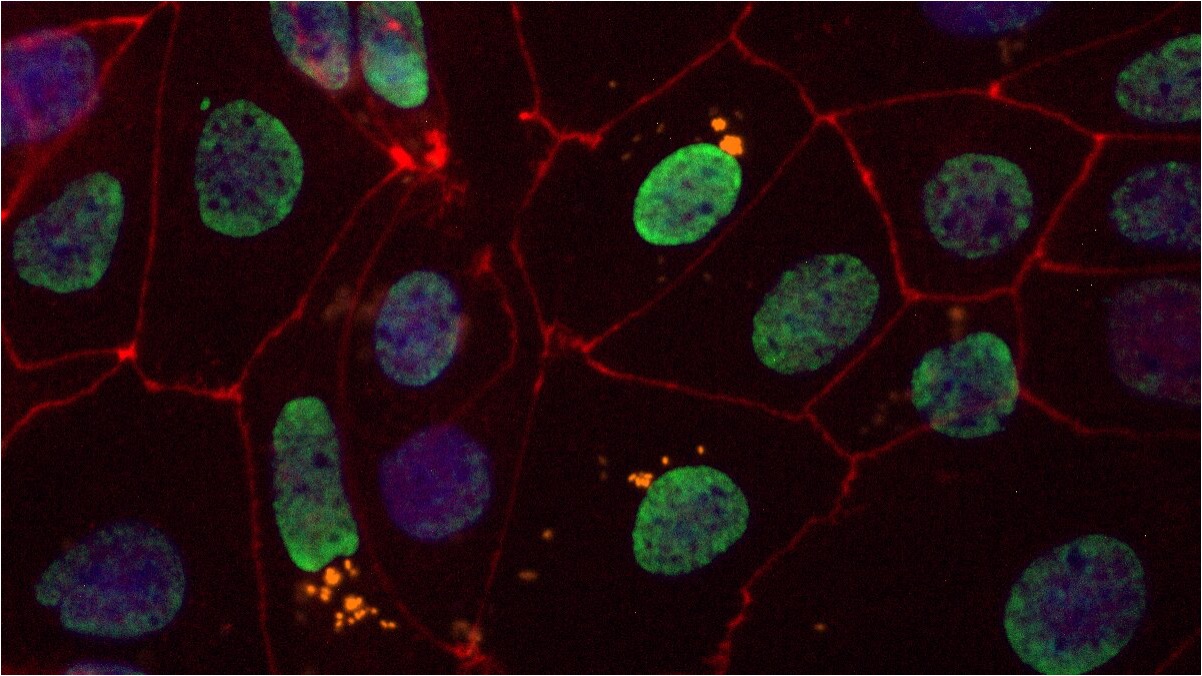 One Question, Millions of Cells: How MALVINA Was Born