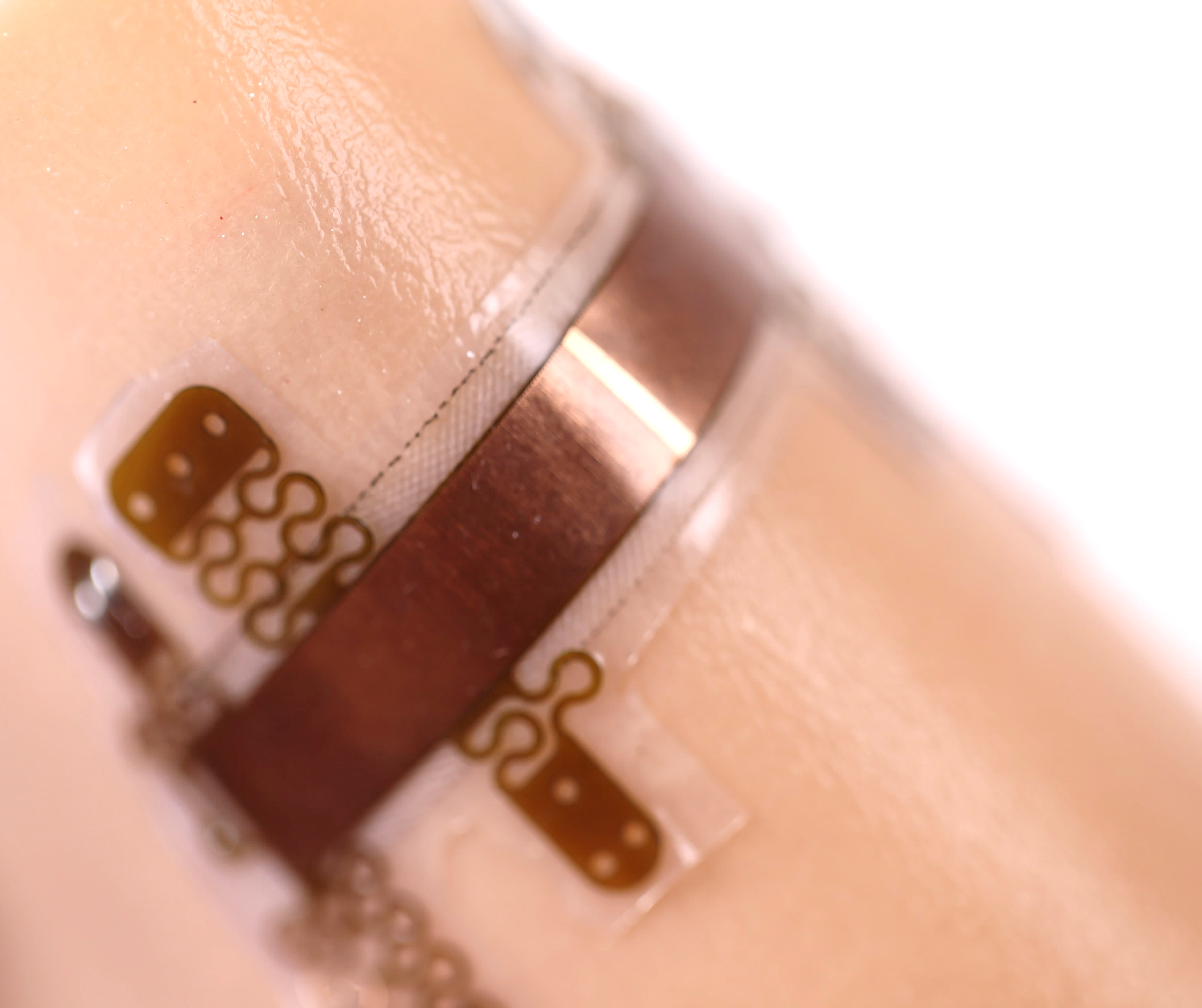 A Wearable Device to Protect Dialysis Patients' Lifelines