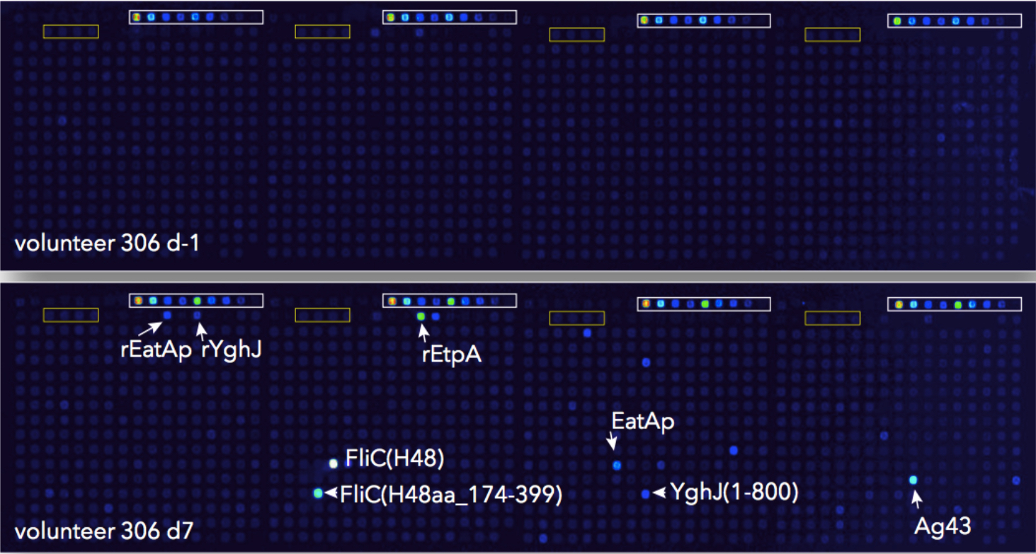 What are we missing?  Comparing the immunoproteomes of enterotoxigenic E. coli infected and vaccinated hosts can yield insights for rational vaccine design. 