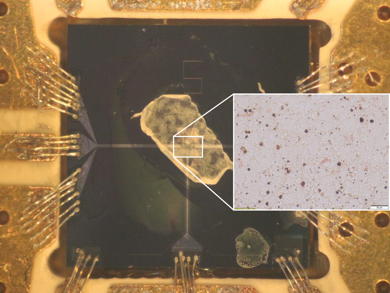After the Paper: Towards detecting single spins, imaging spins and sensing biomaterial using a single superconducting artificial atom