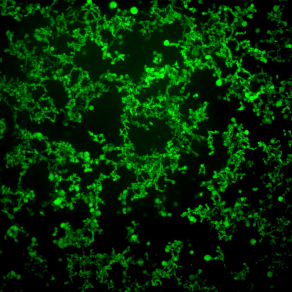 In the pursuit of FAME, one fatty acid at a time